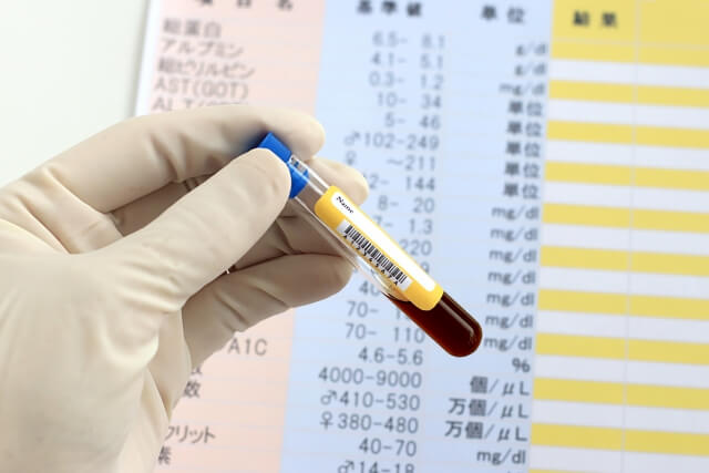 MCIスクリーニング検査とは?